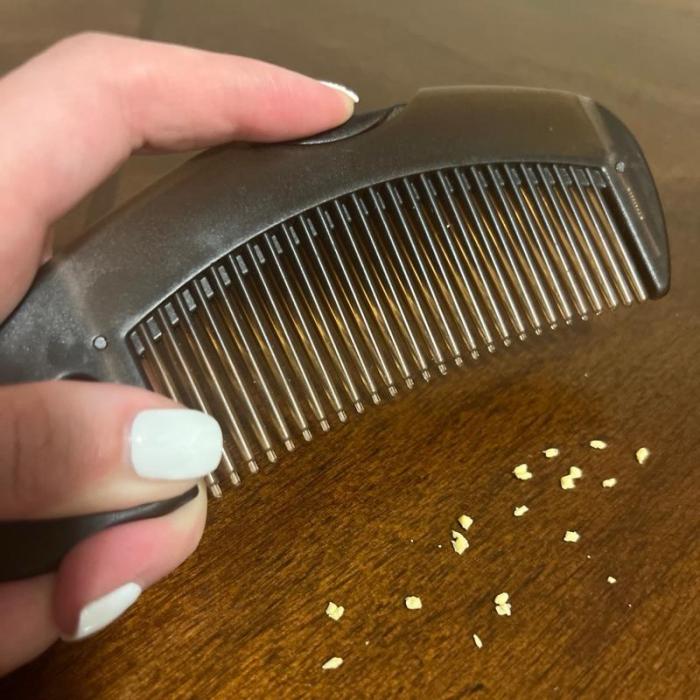 Scalp Sweep™ Detox Comb